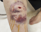 هشدار معاون بهداشت دانشگاه علوم پزشکی اردبیل به مناسبت هفته جهانی زئونوز: «سلامت واحد» راه مقابله با بیماری‌های مشترک انسان و دام است