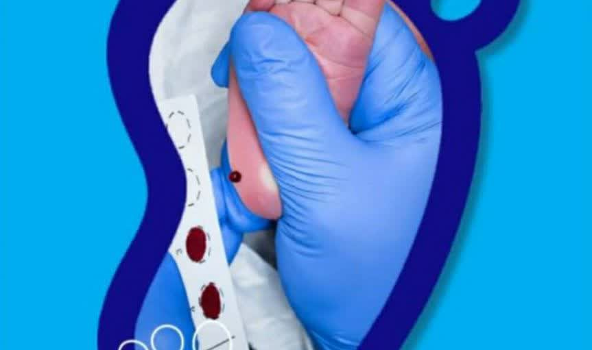 غربالگری موفقیت‌آمیز بیش از ۱۲ هزار نوزاد در استان اردبیل انجام شد